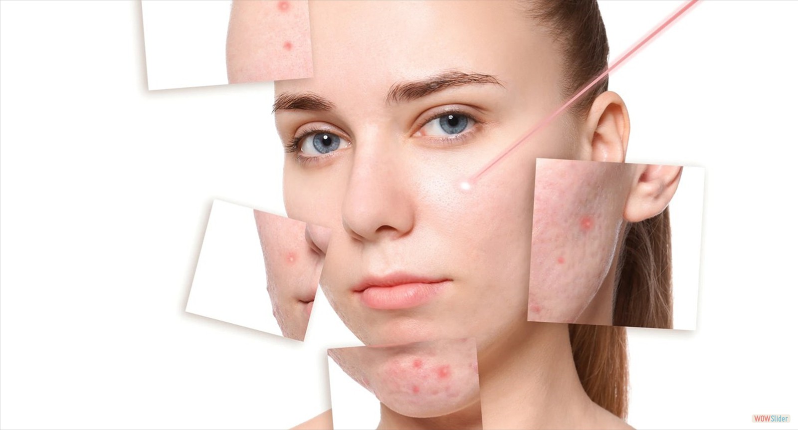 Enfermedades Cutaneas