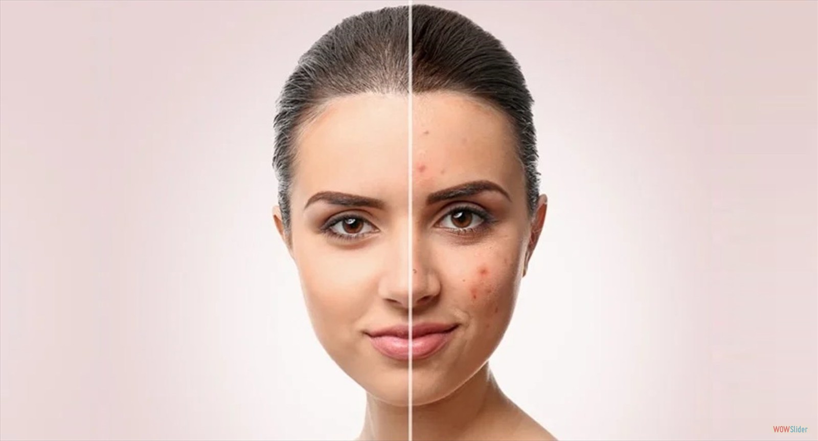 Enfermedades Ampollosas